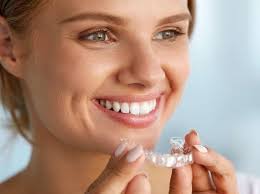 Invisible Aligners